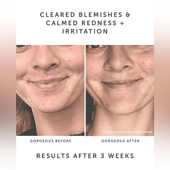 Earth harbor SAMPHIRE Biotic Perfecting Serum - Picture 3 of 6